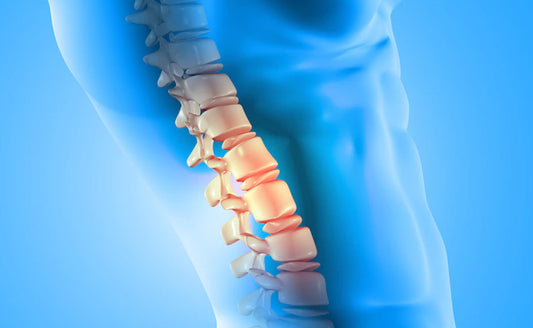 Ankylosing Spondylitis