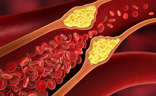 Cholesterol