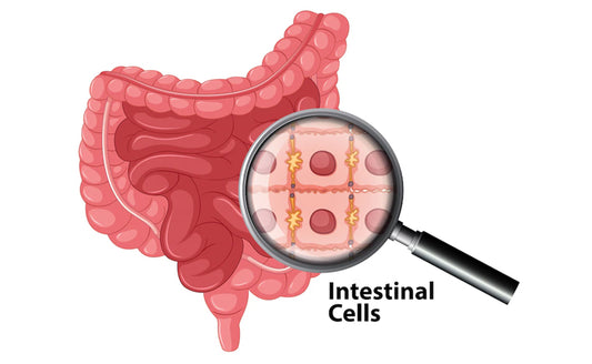 Irritable Bowel Syndrome