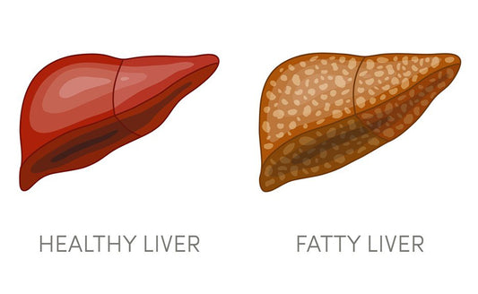 Fatty liver