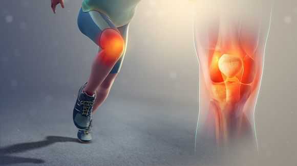 A person jogging and having knee joint pain and its vector
