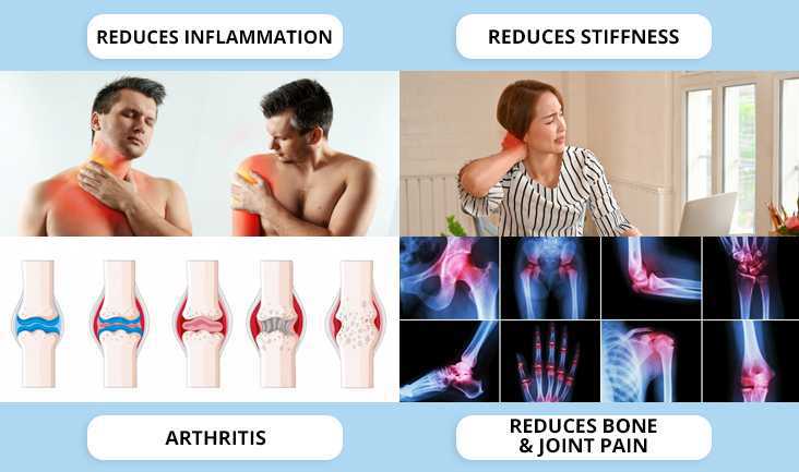 4 collage photos of a person with shoulder & neck pain, a woman with back pain, joint deformation, and joint pain x-rays. Text written respectively- Reduces inflammation, reduces stiffness, arthritis, and reduces bone & joint pain.