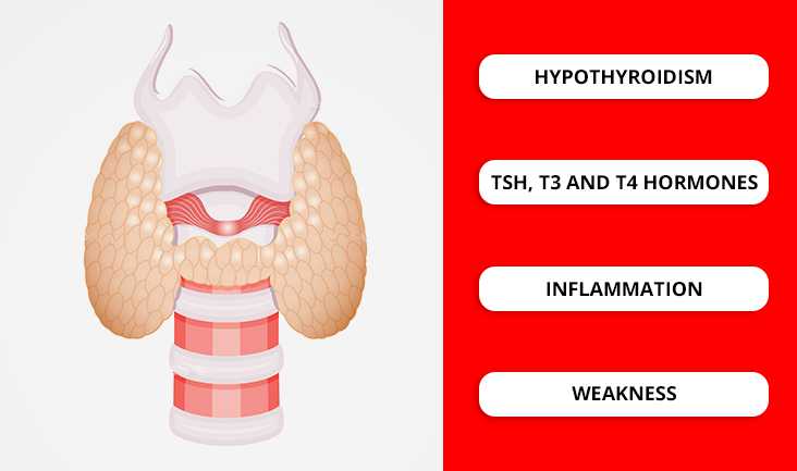 Thyroid gland vector. Text written- Hypothyroidism, TSH, T3 and T4 hormones, inflammation, and weakness.