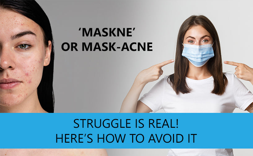 A woman wearing a mask while pointing at her mask and another woman with acne and marks on her face