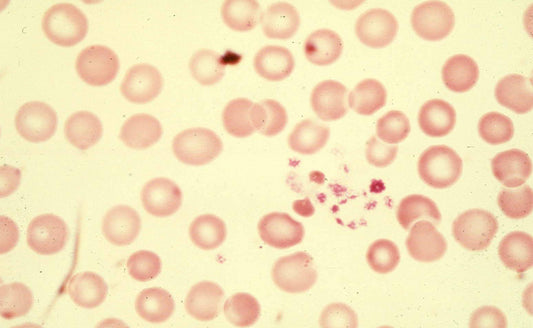 Low Platelets