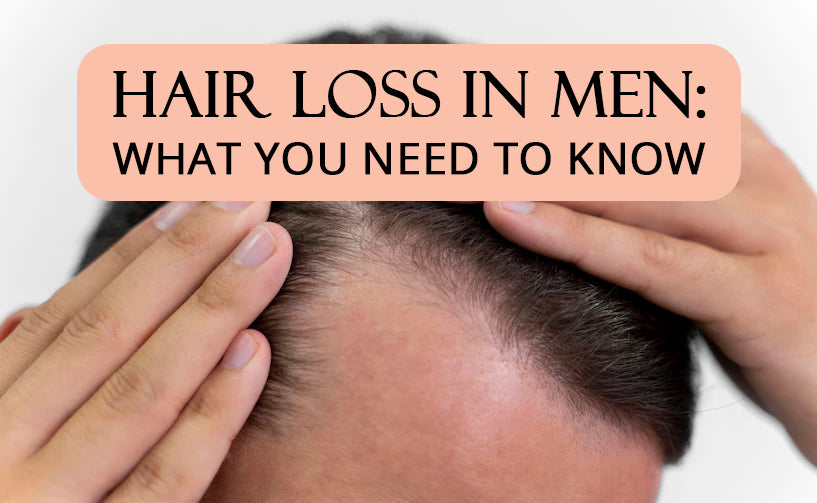Hair Loss In Men: What You Need To Know