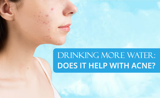 DRINKING MORE WATER: DOES IT HELP WITH ACNE?