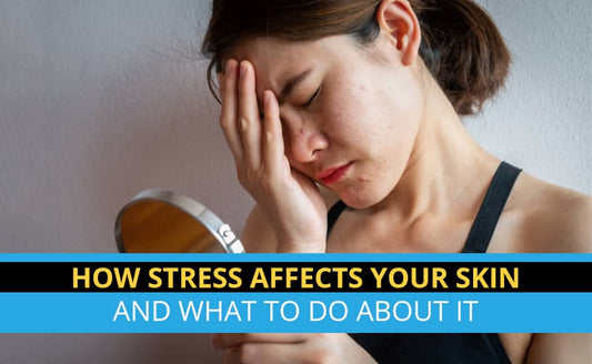 How Stress Affects Your Skin & What to do About It