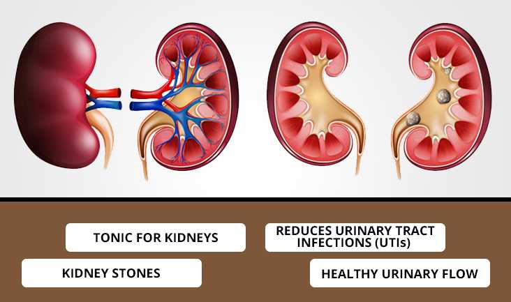 Two vector images of kidneys and kidney stones. Text written: Tonic for kidneys, reduces urinary tract infections (UTIs), kidney stones, and healthy urinary flow.