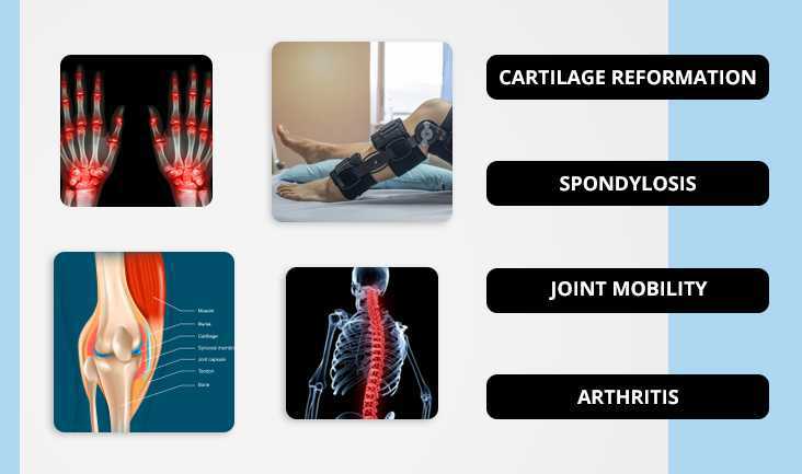 A collage of 4 photos showing- hand joint problems, fractured leg, Knee joint vector, and backbone pain vector. Text written respectively- Cartilage reformation, Spondylosis, Joint Mobility, and Arthritis.