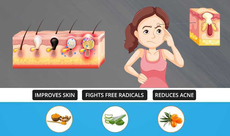 Vector of stages of skin acne and a woman suffering from it. Text written- Improves skin, fights free radicals and reduces acne.