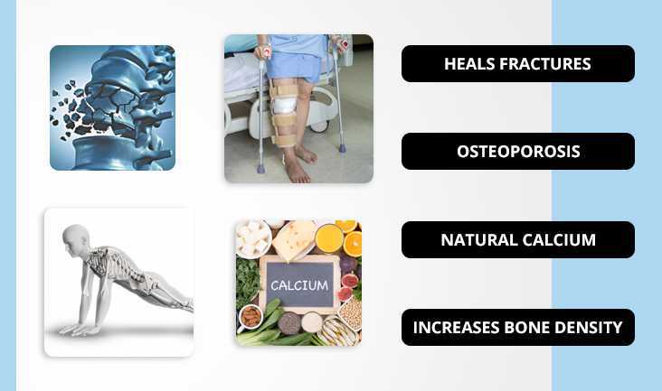 A collage of 4 photos showing: A fractured bone vector, A person with a fractured leg with two crutches in the hospital, A vector of a person’s skeleton system while doing a push-up, and calcium written on a slate with healthy calcium food. Text written: Heals fractures, Osteoporosis, Natural Calcium, and Increases Bone Density.