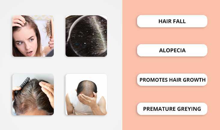 A collage of 4 images showing: A tensed woman with hair fall, Dandruff on the scalp, A man combing his grey & thin hair, and a man stressed due to partial baldness. Text written respectively: Hair fall, Alopecia, Promotes hair growth, and Premature greying.